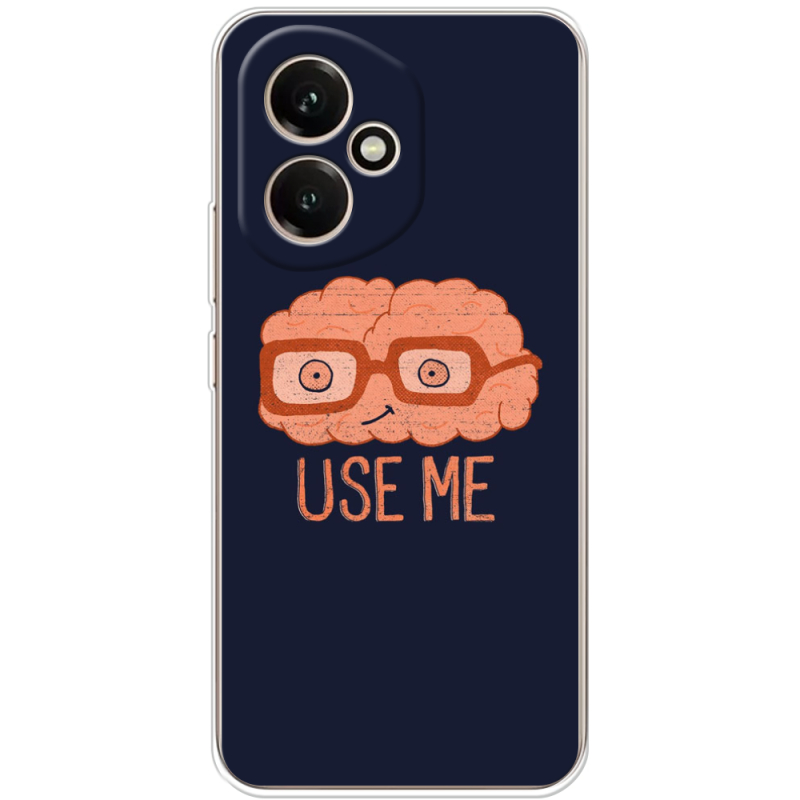 Чохол BoxFace Honor 400 