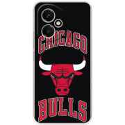 Чохол BoxFace Honor 400 