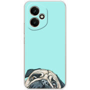 Чохол BoxFace Honor 400 