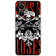 Чохол BoxFace Honor 400 