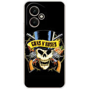 Чохол BoxFace Honor 400 