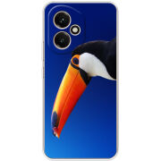 Чохол BoxFace Honor 400 