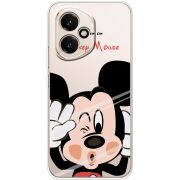 Прозорий чохол BoxFace Honor 400 Mister M