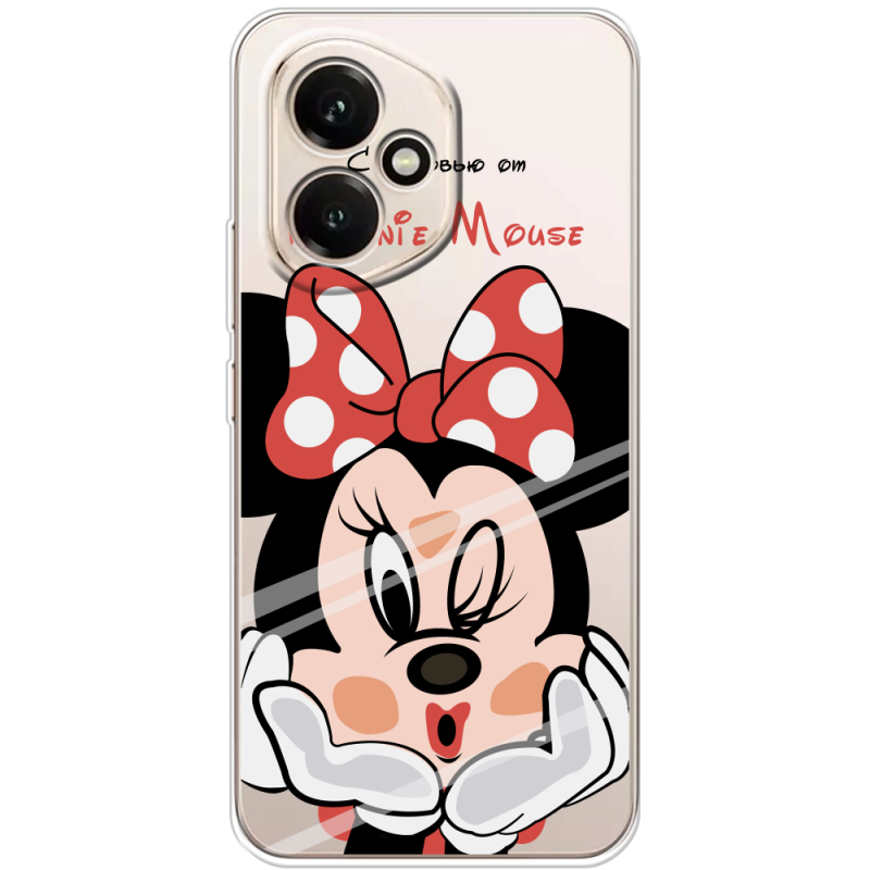 Прозорий чохол BoxFace Honor 400 Lady M