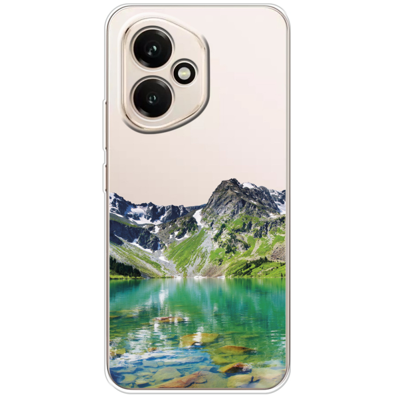 Прозорий чохол BoxFace Honor 400 Green Mountain