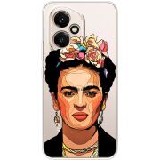 Прозорий чохол BoxFace Honor 400 Фрида Кало