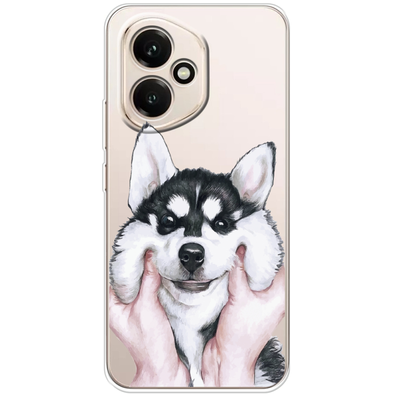 Прозорий чохол BoxFace Honor 400 Husky