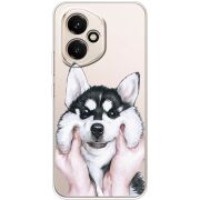 Прозорий чохол BoxFace Honor 400 Husky
