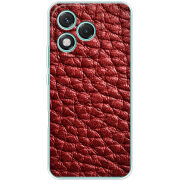 Чохол BoxFace Honor 400 Lite 