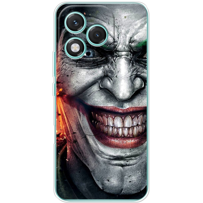 Чохол BoxFace Honor 400 Lite Prankster