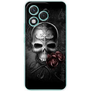 Чохол BoxFace Honor 400 Lite 