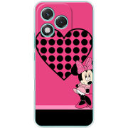 Чохол BoxFace Honor 400 Lite 