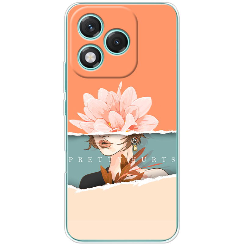 Чохол BoxFace Honor 400 Lite 