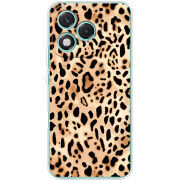 Чохол BoxFace Honor 400 Lite 