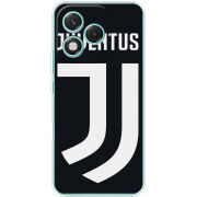 Чохол BoxFace Honor 400 Lite FC J