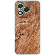 Чохол BoxFace Honor 400 Lite 