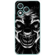 Чохол BoxFace Honor 400 Lite 