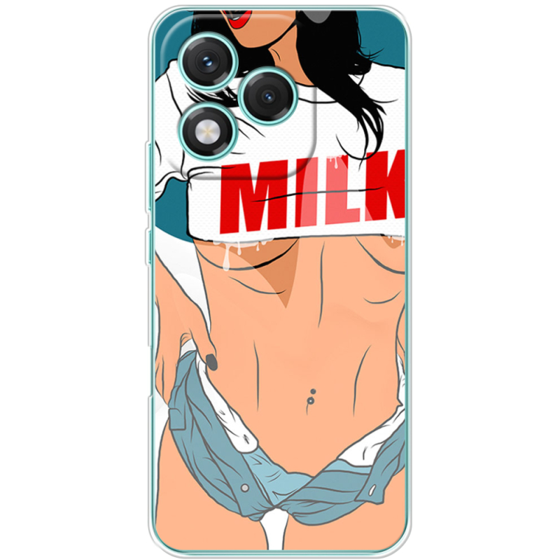 Чохол BoxFace Honor 400 Lite 