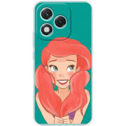 Чохол BoxFace Honor 400 Lite 