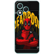 Чохол BoxFace Honor 400 Lite 