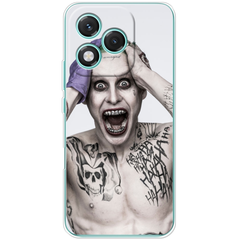 Чохол BoxFace Honor 400 Lite 