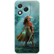 Чохол BoxFace Honor 400 Lite Raya