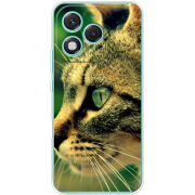 Чохол BoxFace Honor 400 Lite 