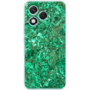 Чохол BoxFace Honor 400 Lite 