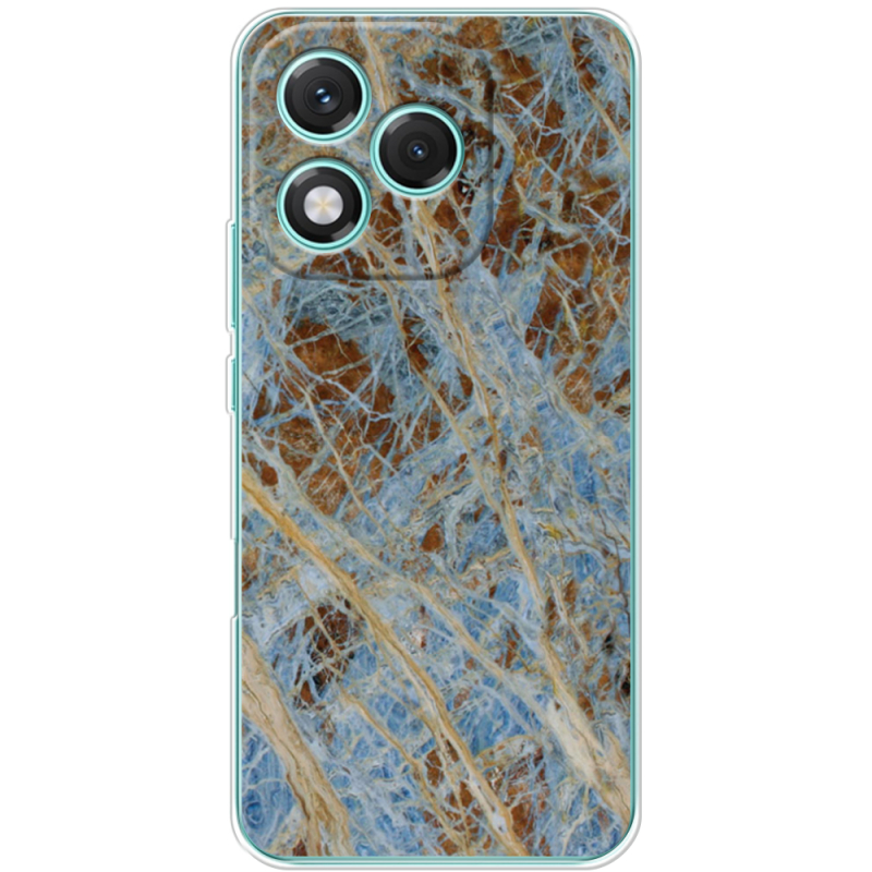 Чохол BoxFace Honor 400 Lite 