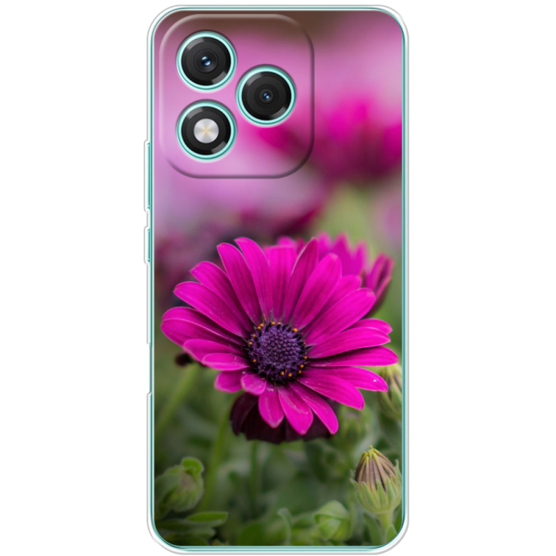 Чохол BoxFace Honor 400 Lite 