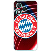 Чохол BoxFace Honor 400 Lite 