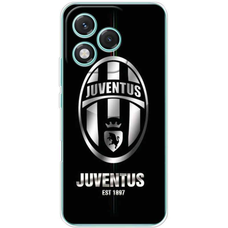 Чохол BoxFace Honor 400 Lite 