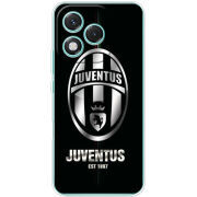 Чохол BoxFace Honor 400 Lite 