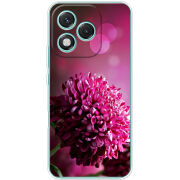 Чохол BoxFace Honor 400 Lite 