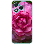 Чохол BoxFace Honor 400 Lite 