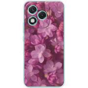 Чохол BoxFace Honor 400 Lite 