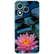 Чохол BoxFace Honor 400 Lite 