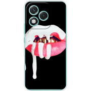 Чохол BoxFace Honor 400 Lite 