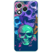 Чохол BoxFace Honor 400 Lite 