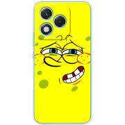 Чохол BoxFace Honor 400 Lite 