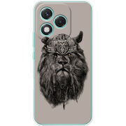 Чохол BoxFace Honor 400 Lite 