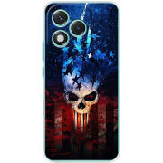 Чохол BoxFace Honor 400 Lite 