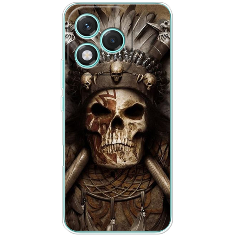 Чохол BoxFace Honor 400 Lite 