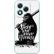 Чохол BoxFace Honor 400 Lite 