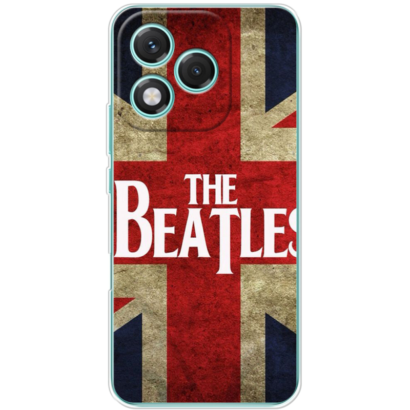 Чохол BoxFace Honor 400 Lite 