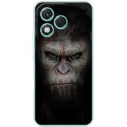 Чохол BoxFace Honor 400 Lite 