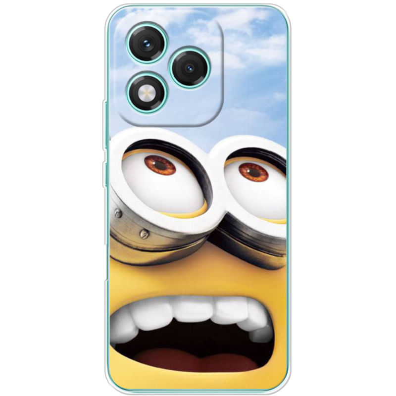 Чохол BoxFace Honor 400 Lite 