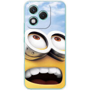 Чохол BoxFace Honor 400 Lite 