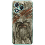 Чохол BoxFace Honor 400 Lite 