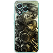 Чохол BoxFace Honor 400 Lite 